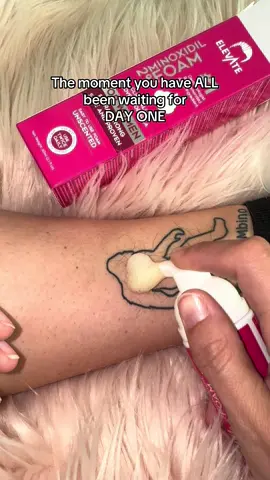 Everyone says this gives the best results for hair growth! Let’s see!!! Here’s to day one ! #tiktokshop #tiktokmademebuyit #hair #hairgrowth #hairgrowthtips #tattoo #tattoos #tattooideas #tattootiktok #hairtransformation #journey #tattedmom #fyp 