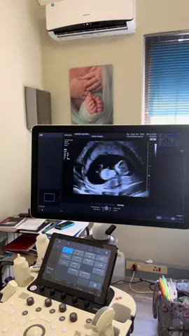 12weeks pregnancy scan #12weekscan 