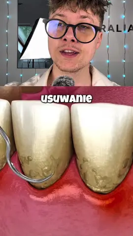 Od skalingu ręcznego do skalingu ultradźwiękowego 😁! Link do zakupu szczoteczki znajduje się w opisie mojego profilu. Aktualnie trwa na nią promocja -49%!