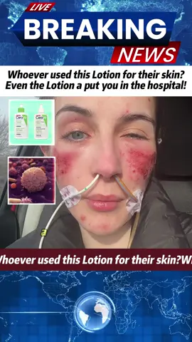 #foryou #viral #news #fyp #cerave 