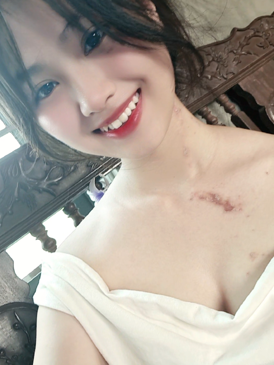 mất vònggg😮‍💨