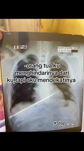 #fypシ゚viral #nosmokinng #paruparubasah #berhentimerokok 