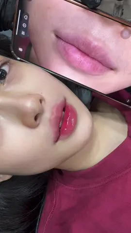 Nhan sắc là thứ trời cho , trời cho ko đủ thì mình dặm thêm . Case môi chỉ 0,5cc thôi #filler #botox  #fullface  #FullFaceDouyin #moi #taivenhtrunghoa