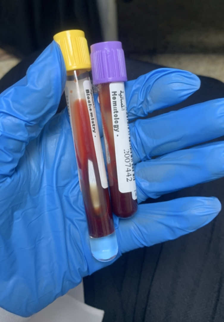 #مختبرات_طبية👩🏻‍🔬💉 #تحليلات_مرضية #مستشفى_اليرموك_التعليمي #سحب دم