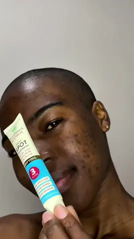 I’ve been using the @African Extracts Daily Spot Treatment and I’m impressed!!🥰🥰 It actually faded my dark spots and cleared my breakouts. Affordable, gentle and it works!!🌿 #darkspots #acneskin #hormonalacne #clearskinroutine #skincarejourney #darkspottreatment #acne #acnecare #skincareresults #acnepositivity #hyperpigmentation 