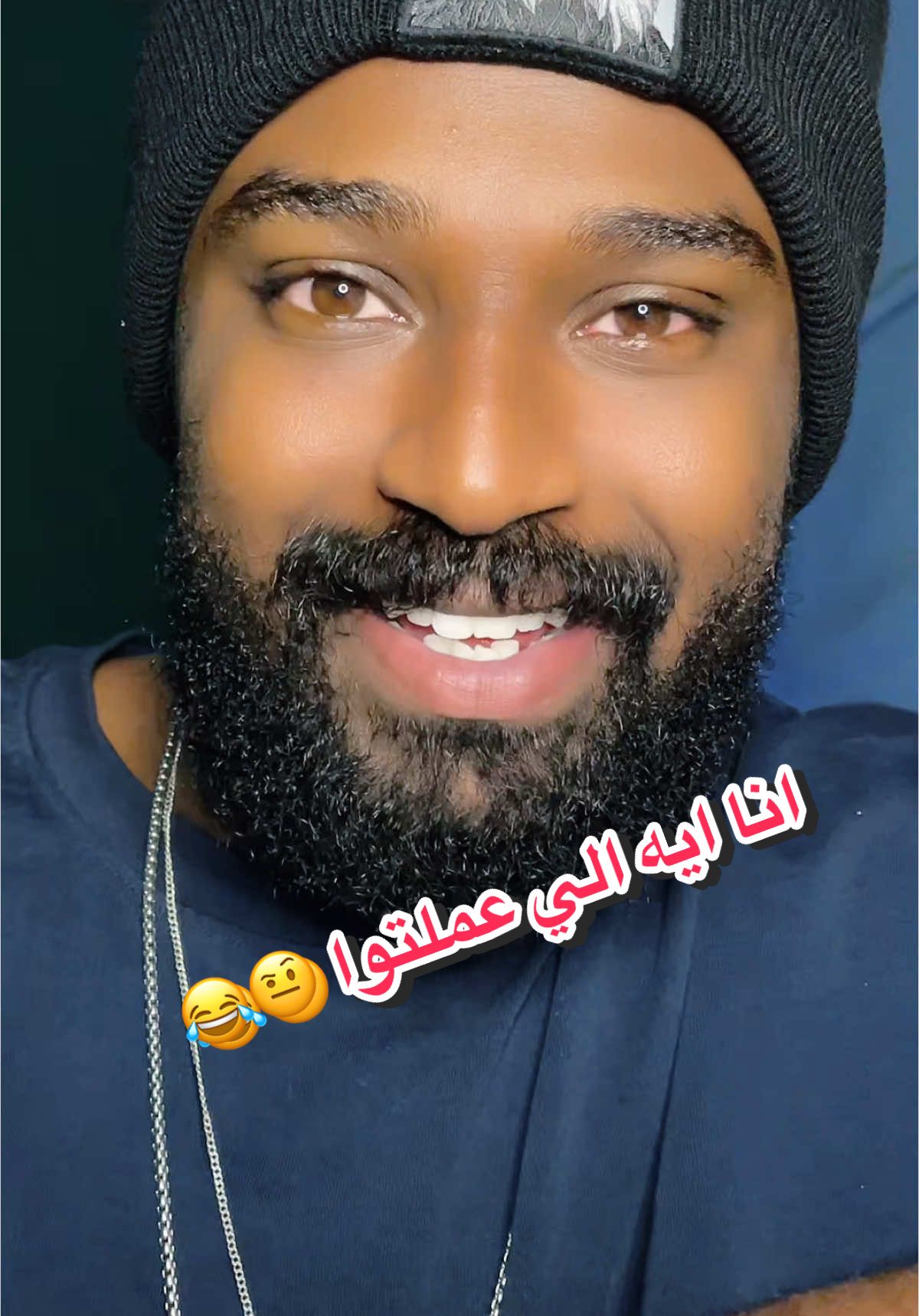 انا ايه الي عملتوا 🤨😂 #شيكو_النوبي #جيش_شيكو_النوبي #شيكوالنوبي 