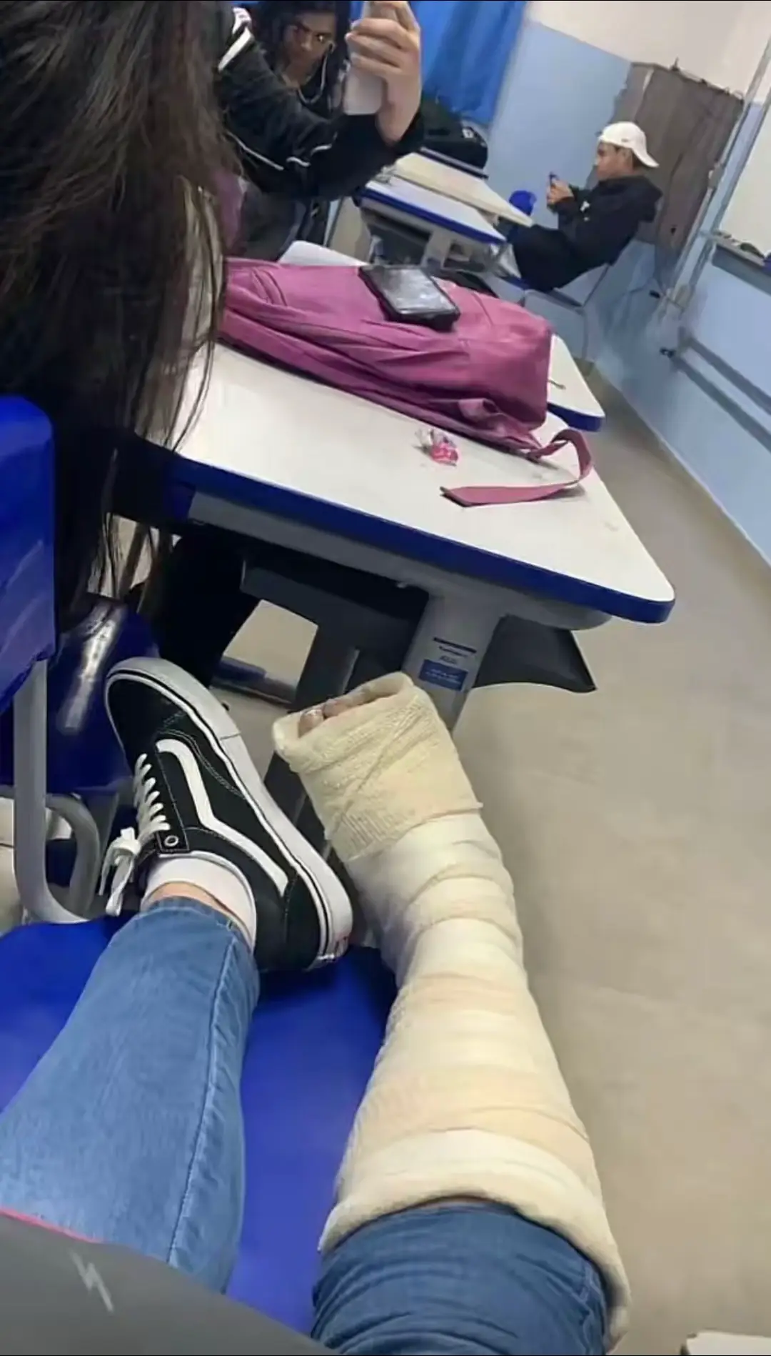 Quebrei a perna agora tô assim 🥺 #gesso3d #gesso #fratura #cast 