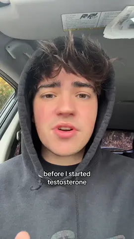 i was SO UGLY. so ugly nd so dumb - #fyp #lgbt #trans #gay #storytime #comedy #trending 
