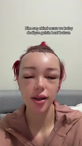Allah bizi yaktı hâlâ gülüyorsun😂😂
