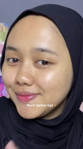 Cuma ganti pembersih wajah tapi bisa sengaruh ini😍 #pembersihwajah #facialwash #springoriginskincare #springorigin #skincareroutine #fyp 