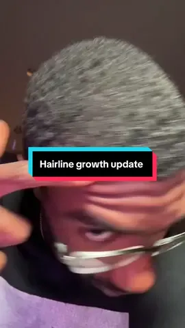I’ll see yall next week #greenscreenvideo #hairgrowth #beardgrowth 