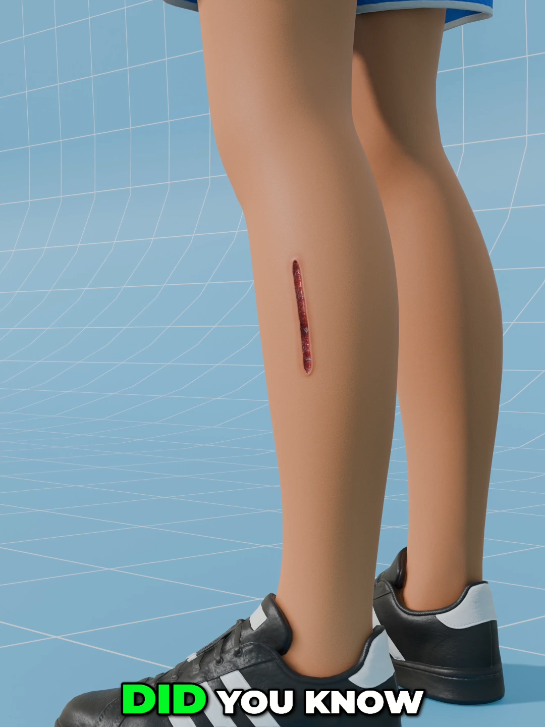 How stiches works? Ever wondered how a small piece of thread can hold skin together after an injury or surgery? What exactly is happening under the surface when doctors sew you up with stitches? Whether you've had a cut, surgery, or seen a medical drama on TV, you’ve probably seen stitches—but how do they actually work? In this video, we break down the fascinating process of how stitches work, why they’re necessary, the science behind wound healing, and what happens to your body while it's healing with sutures. If you’ve ever been curious about medical procedures, anatomy, or just love learning how the body repairs itself—this one’s for you. 🧵 What Are Stitches? Stitches—also known as sutures—are a medical technique used to close wounds or surgical incisions so the body can heal properly. They help bring the edges of the skin together, holding them in place while new tissue grows underneath. Think of them as internal scaffolding—temporary supports that give your body time to rebuild. Sutures can be: Absorbable (dissolve over time inside the body) Non-absorbable (must be removed manually once healing is complete) They come in different materials: nylon, silk, polyester, or even catgut (made from sheep intestines). Each has a different use depending on the body part and wound type. 🧠 The Science of Healing with Stitches When your skin is cut or sliced open, the first thing your body does is trigger a healing response: Inflammation – blood rushes to the area, clotting begins Proliferation – skin cells regenerate, forming new tissue Maturation – tissue strengthens and returns to normal But without stitches, deep wounds might not close evenly or quickly. Open wounds are vulnerable to infection, scarring, or poor healing.Stitches bring skin layers into close contact so they can fuse seamlessly. They reduce healing time, minimize scarring, and improve the outcome—especially after surgeries or serious injuries. 🩺 When Are Stitches Used? Doctors use stitches in many situations: #HowStitchesWork #MedicalExplained #WoundCare101 #StitchingScience #SurgicalSutures #EmergencyRoomLife #MedicalShorts #DoctorExplains #StitchesExplained #HealingWithStitches #FirstAidTips #CutCare #DeepWounds #HowDoctorsFixYou #HealthEducation #WhatHappensInSurgery #SurgicalProcess #MedicalTikTok #ERExplained #WoundCare #LearnOnTikTok #ScienceForEveryone #BiologyFacts #AnatomyBasics #STEMOnTikTok #BodyExplained #MedicalKnowledge #FunWithScience #QuickLesson #BrainSnacks #SmartScroll #StudyBreakFacts #HealthScience #HumanBiology #SimpleScience #MindBlownFacts #EducationalContent #MedicalEducation #FunFactsEveryday #HealthExplained #FYP #ForYouPage #TikTokIndia #ViralNow #TrendingToday #ExploreReels #TikTokDaily #ScrollStopper #MustWatchVideo #BeforeYouScroll #WatchTillEnd #WeirdFacts #TikTokRewind #NextOnMyFeed #DailyFix #OMGVideos #WildFacts #TikTokInspo #DidYouKnowThat #ExploreNow #CrazyButTrue #WTFacts #EverydayFacts #QuickExplained #WeirdScience #YouNeedToKnowThis #TikTokDoctors #StayCurious #ThingsYouDidntKnow #CuriosityLoop #ViralKnowledge #RealLifeScience #TikTokLearns #InformativeShorts #VisualLearning #HealthOnReels #ShortScienceFacts #BingeWorthyKnowledge #DoctorsOfTikTok #MindBlowingInfo #HealthTalk #InstaLearn #ShortsExplained #FactsOverFiction #TikTokCurious #QuickFacts #TikTokExplains #ScrollingSmarter #ForYouScroll #NextLevelShorts #HotRightNow #ScienceWithStyle #DidYouNotice #BehindTheScenesScience #EmergencyTikTok #MedicalHack #ExplainThis #DoctorBreakdown #TheMoreYouKnow #FactTok #ViralShorts #MindBlown #FitnessExplained #QuickFacts #DidYouKnow #DailyMotivation #WorkoutReels #HealthHacks #TrendingFitness #ExplainerVideo #ReelsViral #TikTokTrend #gym #bts #3D #blender #maya