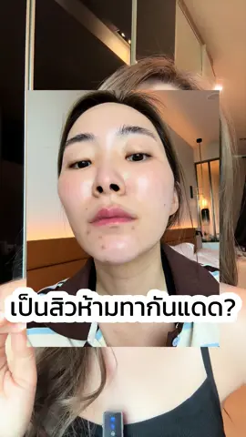 ไอเทมที่คนเป็นสิวต้องลอง มันเวิร์คจริงๆ NIVEA SUN UV SPECIALIST💙 @NIVEA THAILAND  #นีเวียซันยูวีสเปเชียลลิสต์ #เสริมเกราะผิวไม่ไวต่อแดด #กันแดดเสริมเกราะ