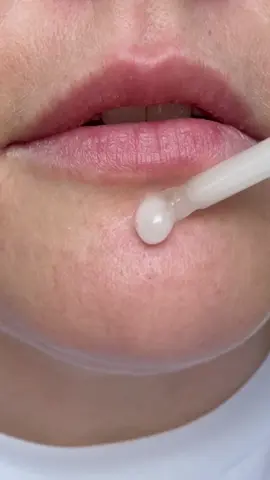 Putting Dr melaxin peel shot to the test because I’m skeptical and need to see for myself #drmelaxin #drmelaxinpeelshot #peelshot #riceampoule #koreanskincare 