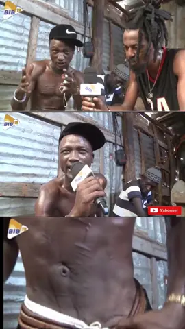 Dof ndeye (cicatrice) #percersurtiktok #wallyseckofficiel #fyp #pourtoi #senegalaise_tik_tok 