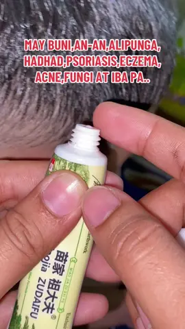 Kung may mga skin problems  ka tulad ng an-an,hadhad, alipunga,psoriasis,acne,fungi,eczema at iba pa etry mo tong zudaifu cream.  #zudaifuoriginal #antibacterial #antibacterialcream #skinproblem #skinointment 