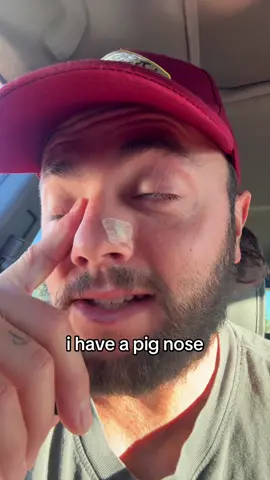 These nose strips open up your nose so much it’s insane😂