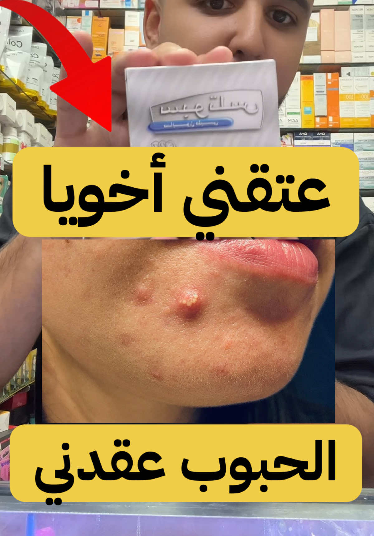 أفضل كريم لعلاج الحبوب الحمراء Cream spotless savon spotless #اكسبلور #fyp #viral #video #skin 
