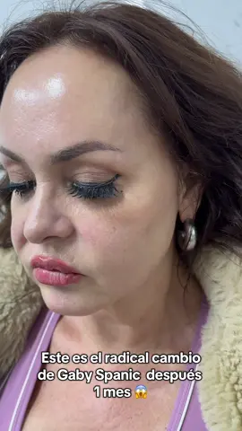 Gaby Spanic …. Este increíble cambio fue gracias al Morpheus 8 pro y esperma de salmón ❤️✨  #fyp #viral #parati #xwzbca #gamarra 