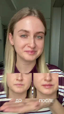VT Cosmetics— Reedle Shot Lip Plumper. Плампер для губ @VTcosmetics_official  Заказать можно тут: https://hollyshop.ru/catalog/product/intensivnyy_plamper_dlya_gub_s_mikroiglami_vt_cosmetics_reedle_shot_lip_plumper_expert/