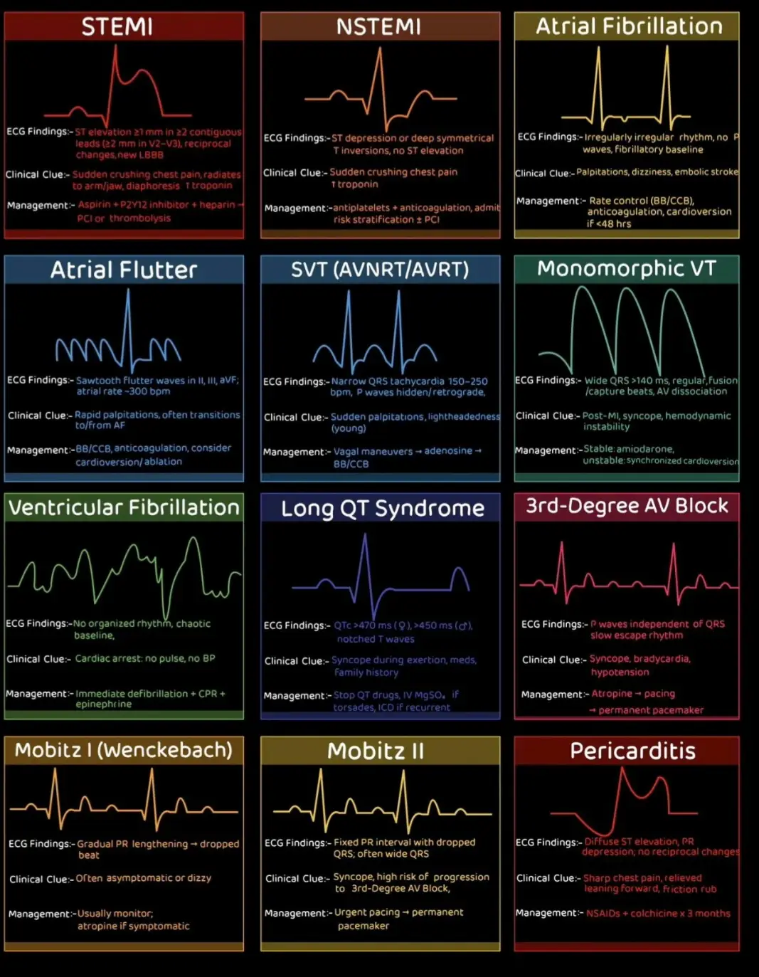 Do you know your ECGs. #ECG #medicine #nursingstudent #cardiologist #nurses 