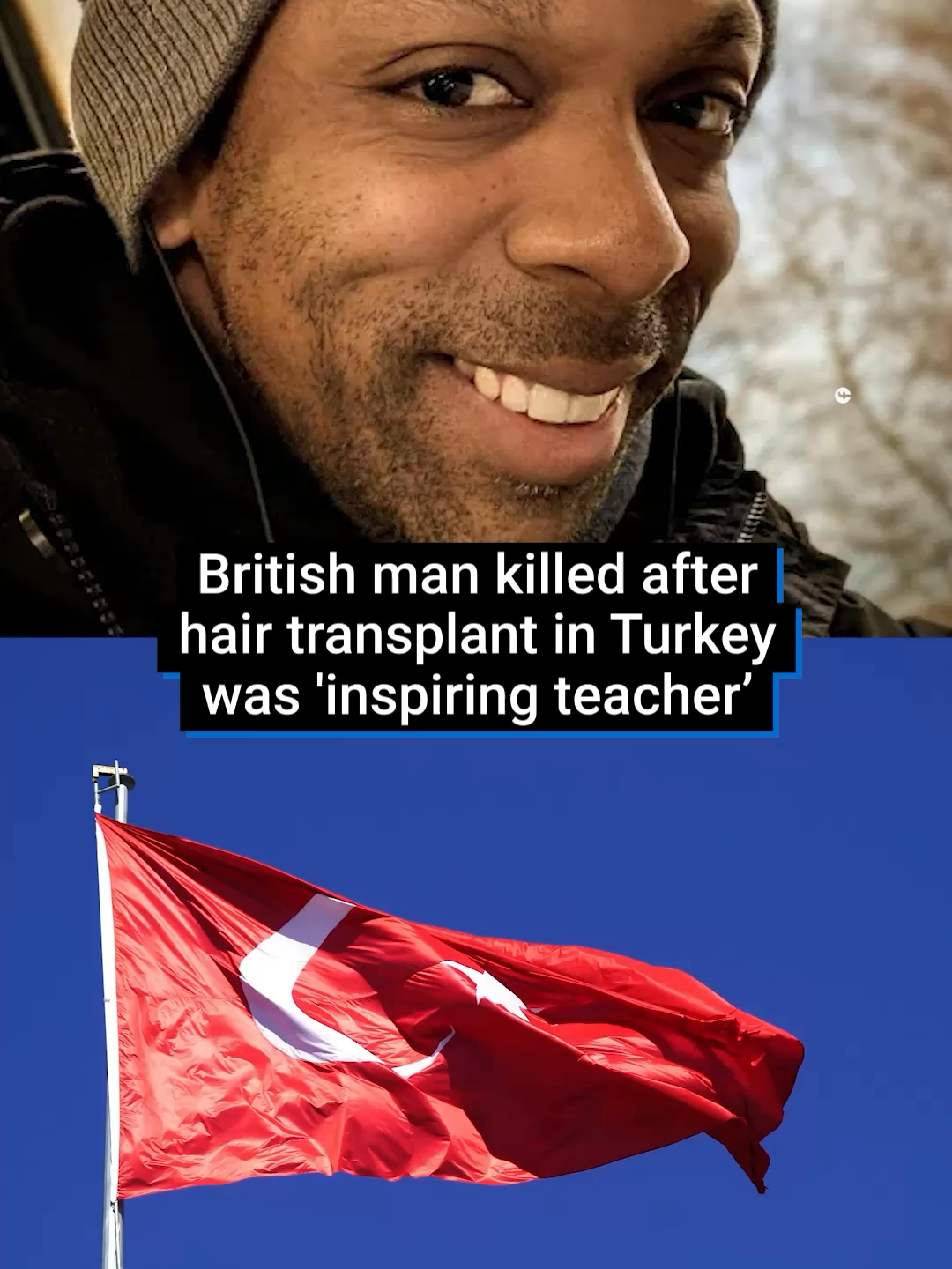 A British man has died after getting a hair transplant in Turkey. 38-year-old Martyn Latchman passed away earlier this week after undergoing the £1,500 procedure at the Dr Cinik clinic in Besikitas, Istanbul. It’s thought he had complications during the 5 hour operation. #turkey🇹🇷 #hairtransplant #rip #UK #istanbul