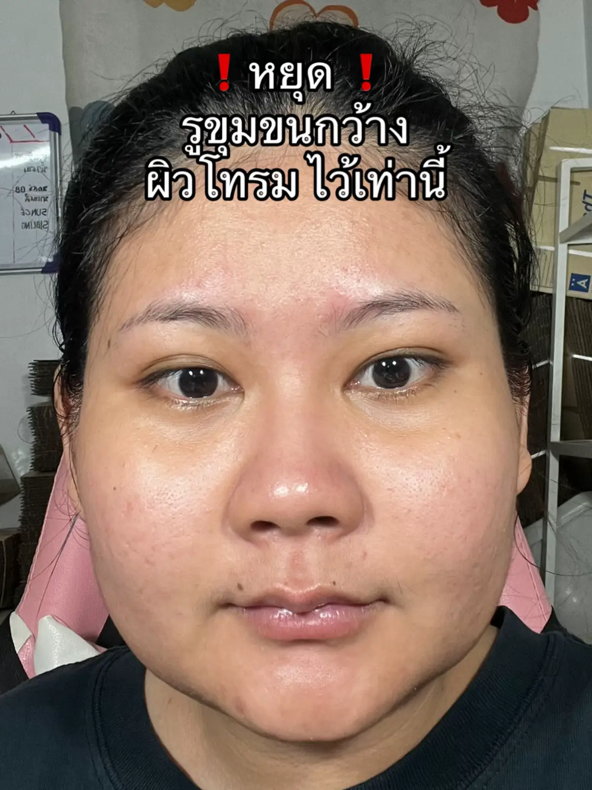 #น้ำตบไมโครเอสเซนต์ #กระชับรูขุมขน #ผิวเรียบเนียน #ผิวชุ่มชื้น 