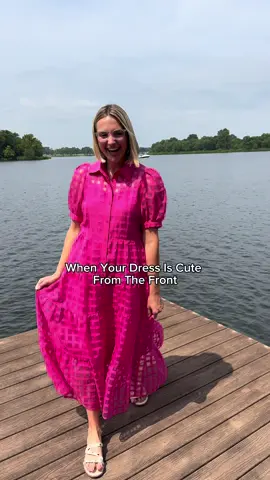 I bought this dress from a sample sale and didn’t know if it had been burnt lol!! Still a cute dress! 