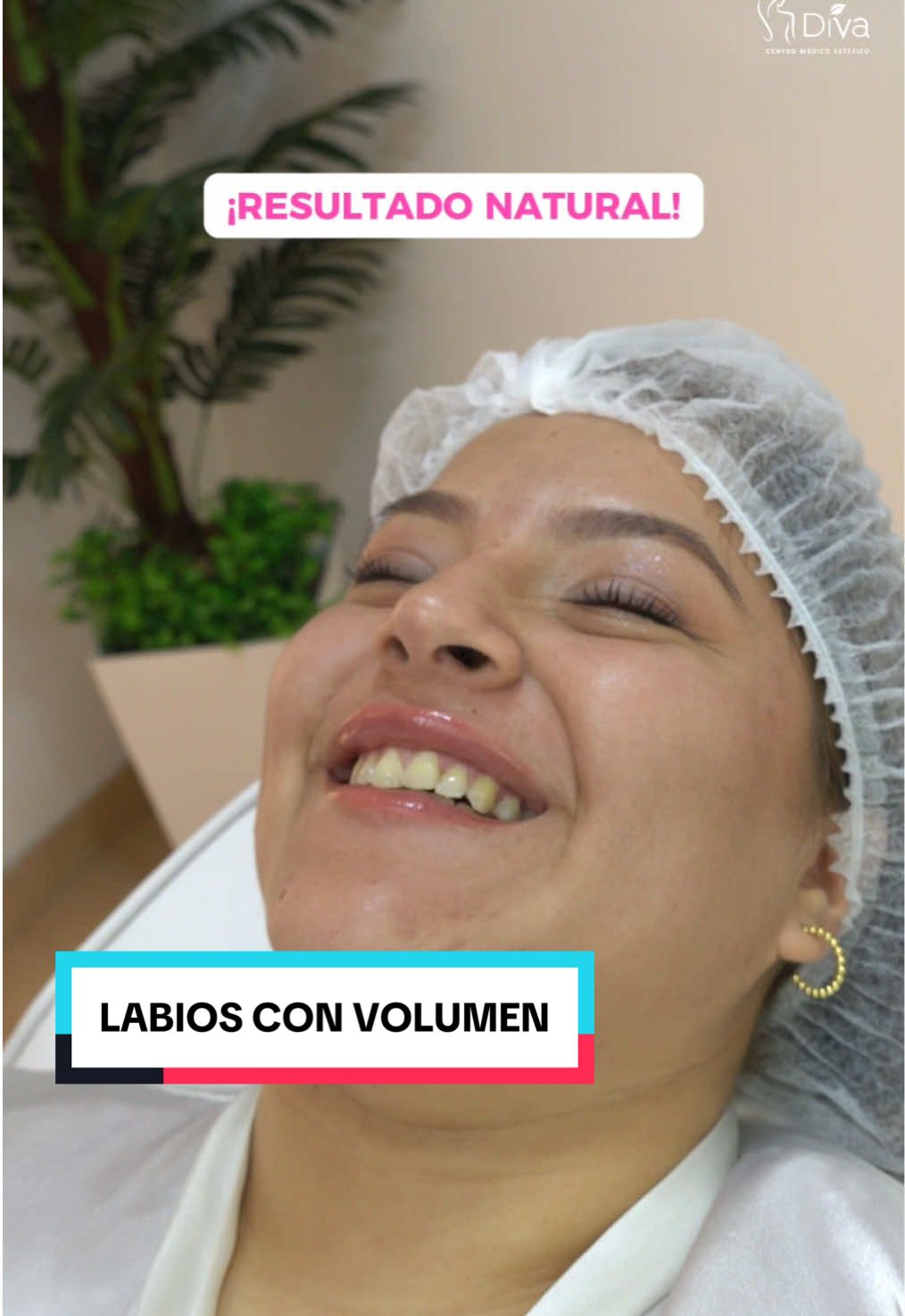 En DIVA, sabemos que es lo mejor para ti, agenda tu cita gratuita y conviertete en tu mejor versión 🤍🤩 #RellenoDeLabios #EstéticaMédicaPerú #diva #medicinaestetica #belleza 