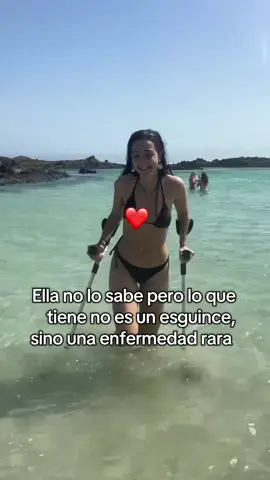 Síndrome autoinflamatorio y otros traumas 🤡 #enfermedadrara #dolorcronico #diagnostico