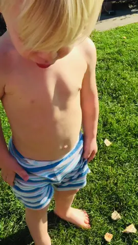 #naturista #🍑