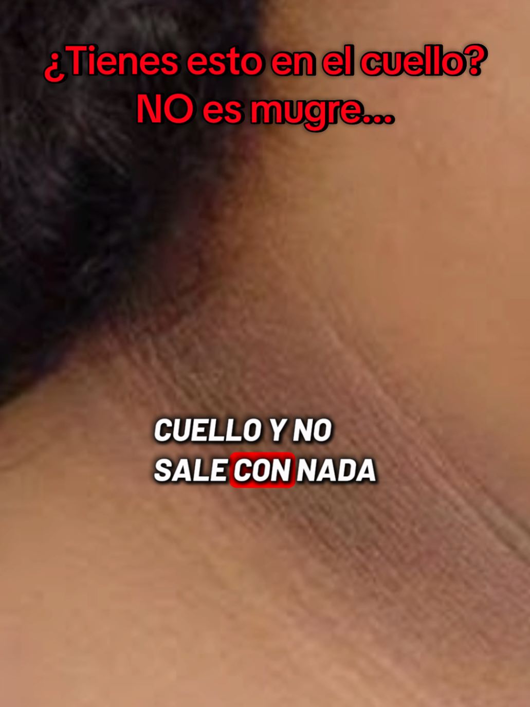 ¿Tienes esto en el cuello? NO es mugre... #salud #piel #curiosidades #medicina #drclip #diabetes #acantosisnigricans 