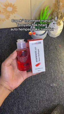 #yonglowskincare #yonglow #yonglowtoner #tonerdarkspot #tonerflekhitam #flekhitam 