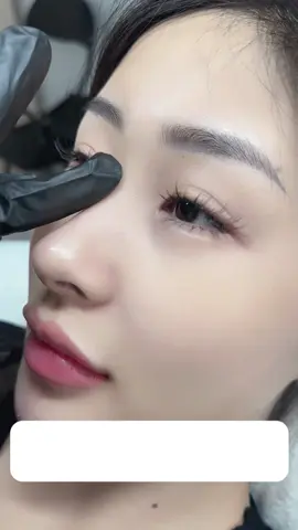 ✅ Filler mũi an toàn - không tràn - dựng trụ đầu mũi , giúp mũi cao bay , sử dụng không quá 1cc  Độ bền 12 - 18 tháng , an toàn  ➡️ Trả kết quả trên khách thật , thay đổi sau 45p  Cần tư vấn ibox mình nhé  #nangmui #fillermui #Yifillercantho #YiBeauty #lamdep 