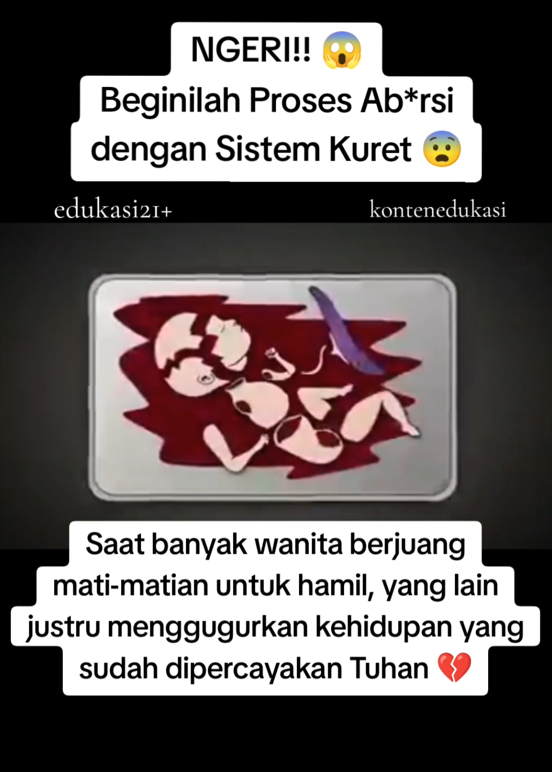 #edukasi #edukasipasutri #konsultasigratis #bisahamil #programhamilsukses #pejuanggarisdua #penantianbuahhati #programhamil #kehamilan 