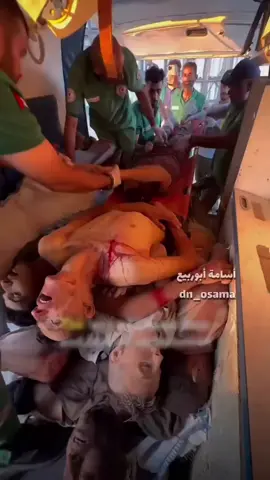 (dn_osama) Eighteen Palestinians were martyred and 198 others injured while attempting to access aid near the Zikim crossing in northern Gaza, according to Fares Afanah, head of emergency and ambulance services in the north. With no functioning health system and a critical shortage of ambulances, first responders were forced to stack bodies and wounded civilians inside a single vehicle during evacuations from al-Sudaniyya. The victims had gathered in desperation for flour and food when Israeli occupation forces opened fire, turning a supposed aid route into a site of mass bloodshed.