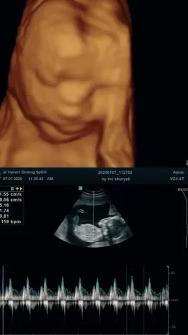 maafin ibu yaaa utun #CapCut #fyp #xbyzca #pregnant 