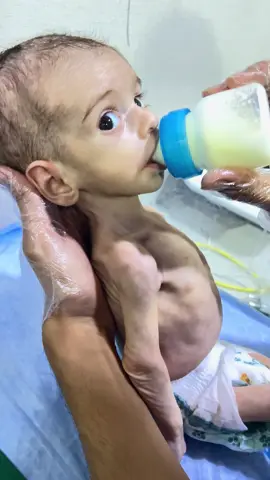 Cute Abubakar Baby Eating Milk 🥛  pray for baby 👶🥺🥺🥺🥺🤗 #NICUBaby #SaveAbubakar #NICURescue #RoyalNurseryUnit #HopeForLife #SaveTheBabies #BabyRecovery #MedicalEmergency #babylife #BloodExchange 
