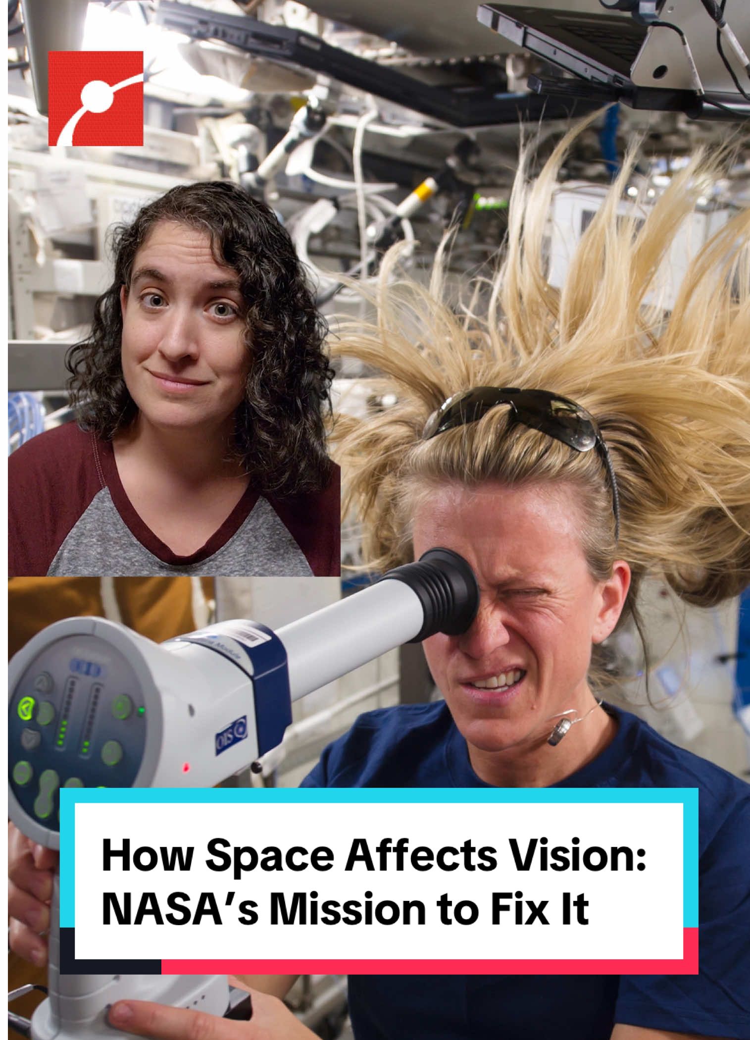 Did you know living in space messes with your eyes? 👀 Microgravity pushes fluids upward, swelling the optic disc and subtly reshaping the eye, a condition called space-associated neuro-ocular syndrome (SANS). NASA’s testing leg cuffs to keep vision sharp on the journey to Mars. #Astronaut #NASA #Microgravity #Eyesight #SpaceExploration #LearnSomethingNew
