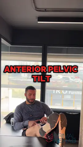 “BREAKING NEWS: Your anterior pelvic tilt isn’t a medical emergency 🤯 Just because your hips tilt forward doesn’t mean your spine is about to explode. Stop blaming posture for everything and start training your body like it was designed to move. - - - - - - -  #PelvicTiltPanic #LowBackPainMyths #PhysioWithFacts #PosturePolice #PrimalRehab”