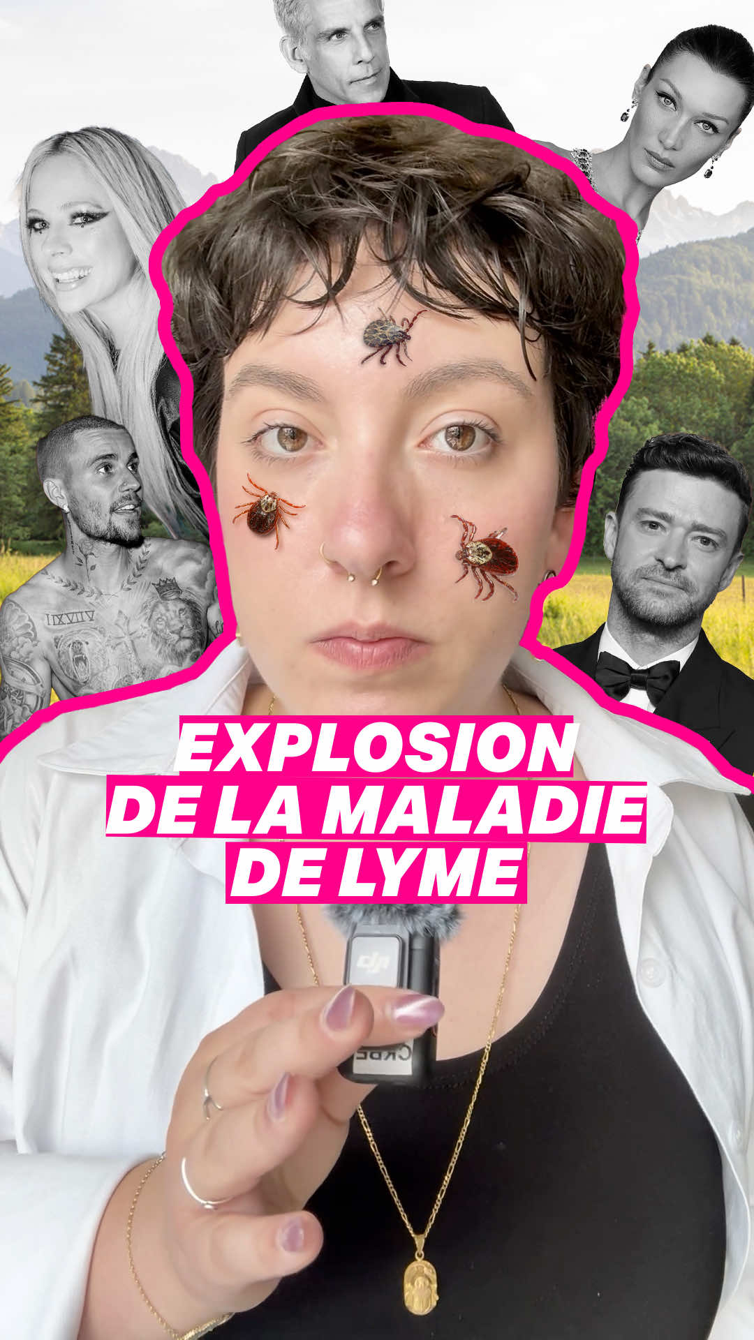 Justin Timberlake atteint de la maladie de Lyme ? Mais c'est quoi exactement ?  La maladie de Lyme doit son nom à une ville du Connecticut, aux États-Unis, où elle a été observée pour la première fois dans les années 1970. On t'explique ‼️ Notre journaliste : @Léa Martin 🎙️ #justintimberlake #lyme #lymedisease #piqures #thique 