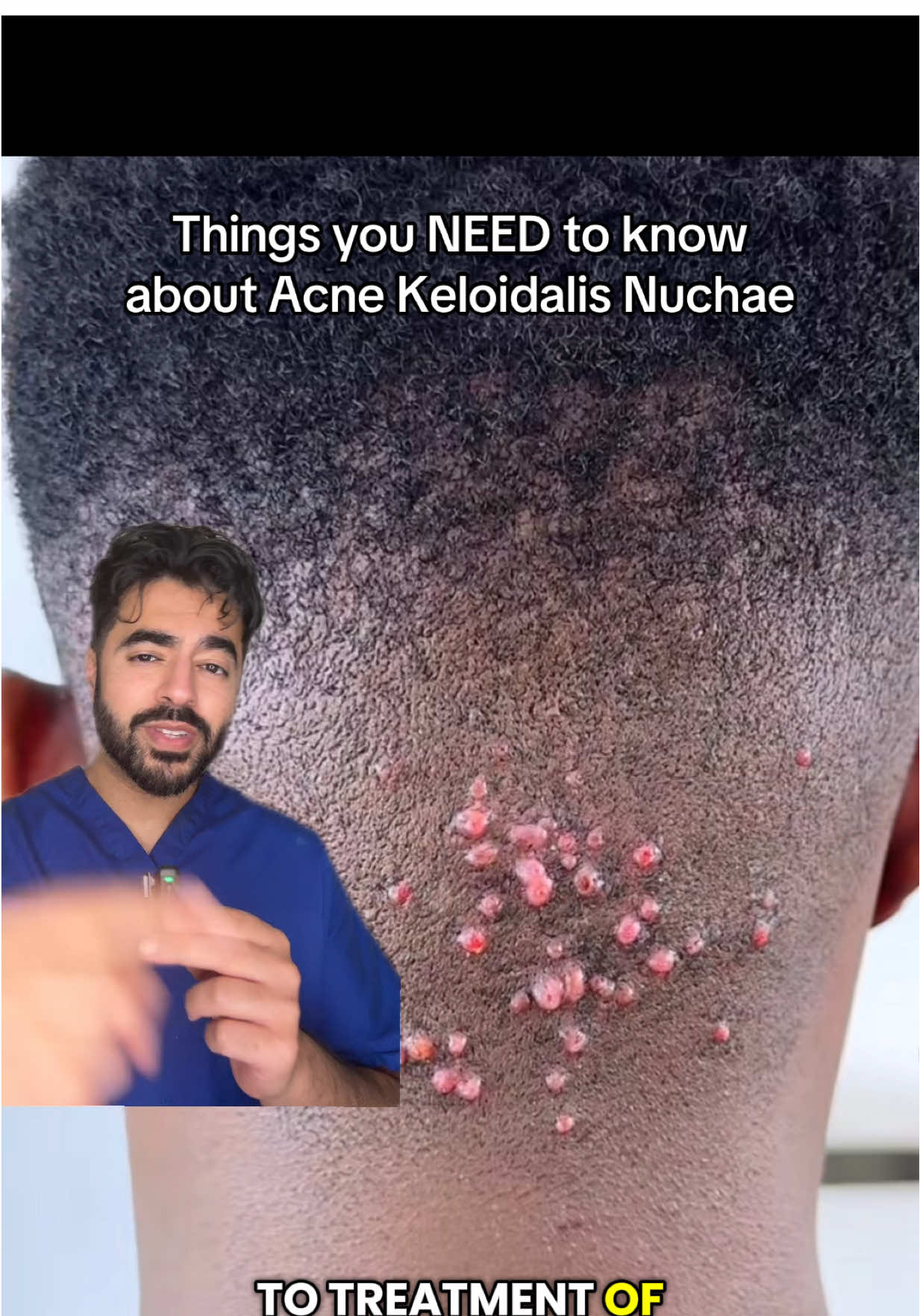 Bumps at the back of the head? #drnomzzy #blackhair #dermatology #HairCareTips 