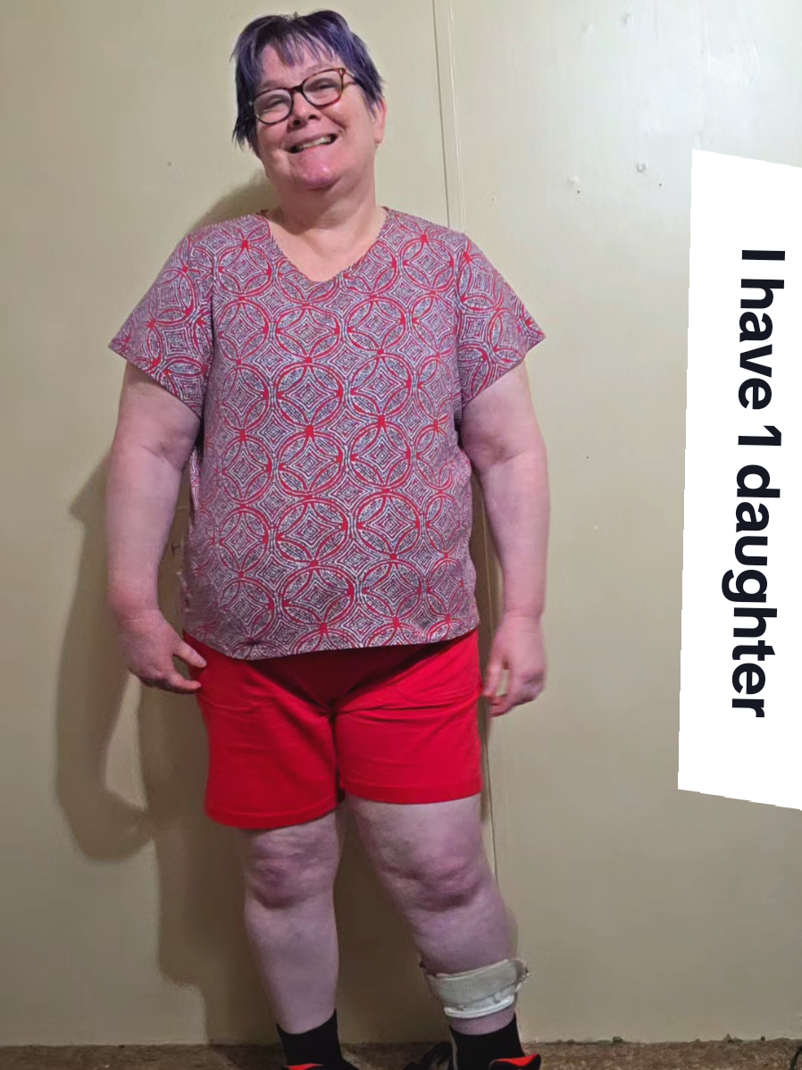 #ihaveonedaughter #disability  #Sarabellwelles 