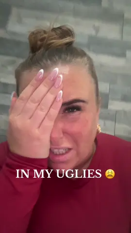 #fupp #uglies #ugly #helpme 