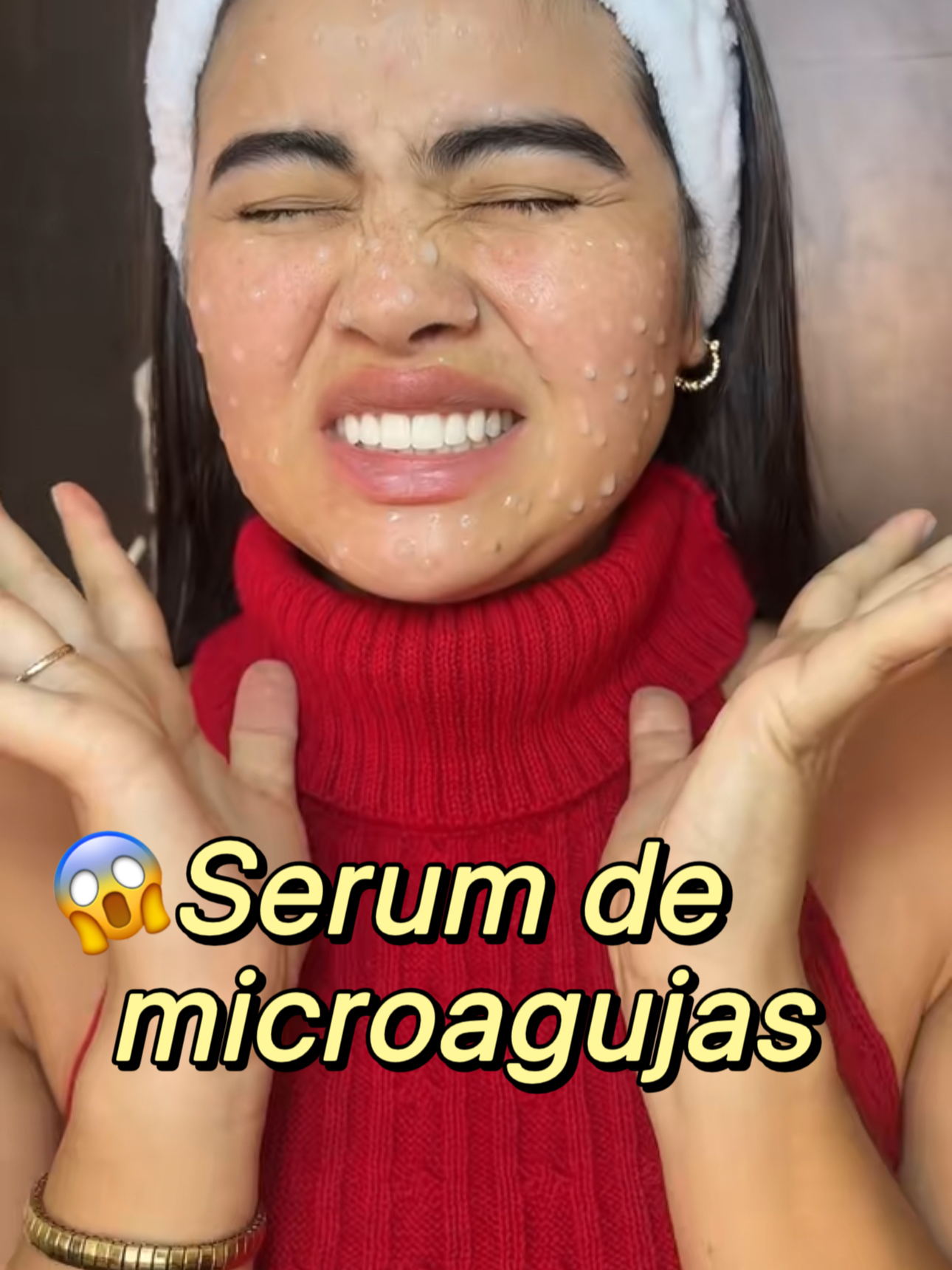 ¿Un serum con microagujas? ¡Sí, leíste bien! 😳 Este de VT Cosmetics tiene 100 agujas de EMI que penetran a capas más profundas de la piel para renovar, alisar y dejarte un glow real. Pica un poquito… pero los resultados lo valen 💉✨  @vtcosmetics_global@vtcosmetics_latam vt #vtcosmetics #vtlatamcrew#skincarecoreano #cosméticacoreana #pdrn #pdrnserum #pdrnessence #pdrnampoule #cicaexosome #kbeauty #skinbooster #glassskin #acneskin #acnetreatment #acneproneskin