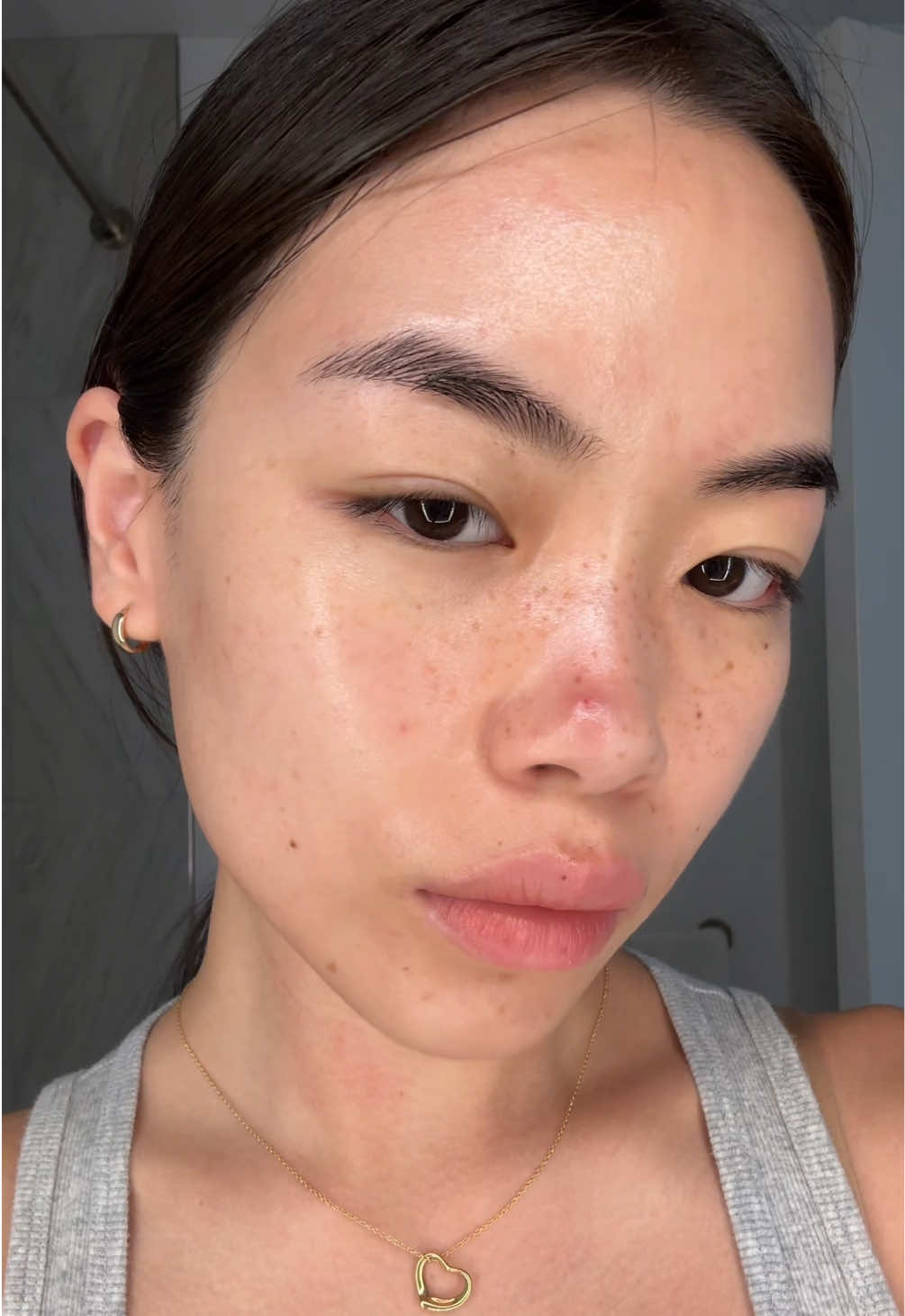 My nose is so happy. Pimpleton or is she a freckle? 🫣😬 (I don’t know what happened to the eye cream footage)  @haruharu wonder soft cleansing gel @anua_global toner, pdrn  @Caudalie vinoperfect serum @Tatcha US sunscreen @cleardea mucin ampoule cream @Genabelle USA @Song Of Skin lip glaze treatment 