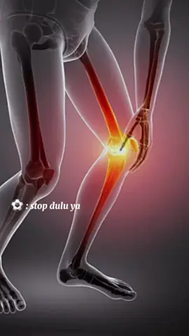 Istirahat untuk sementara waktu #cederalutut #football #acl #mcl #fyp #foryou #foryoupage 