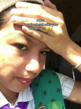 Insecurity 💔💔 #fyppppppppppppp #fypシ゚viral #foryou #fyp #forehead #insecurity #fyppppppppppppppppppppppp #fypage #foryou #everyone #tiktok #people #makeitviral #fyp #wlw #fypp 