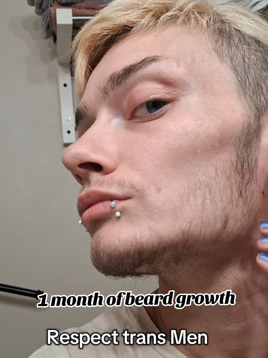 what 1 month of beard growth looks like on me. #intersex #alternative #bearded #transition #trans #femboy #femboi #genderjourney #genderfluidity #genderfluid #gendernonconforming #genderdiversity 