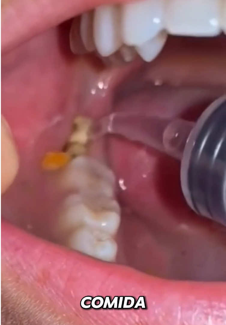 Isso aqui MUDOU totalmente meu hálito e meus dentes 🤌🏻🤌🏻🤌🏻